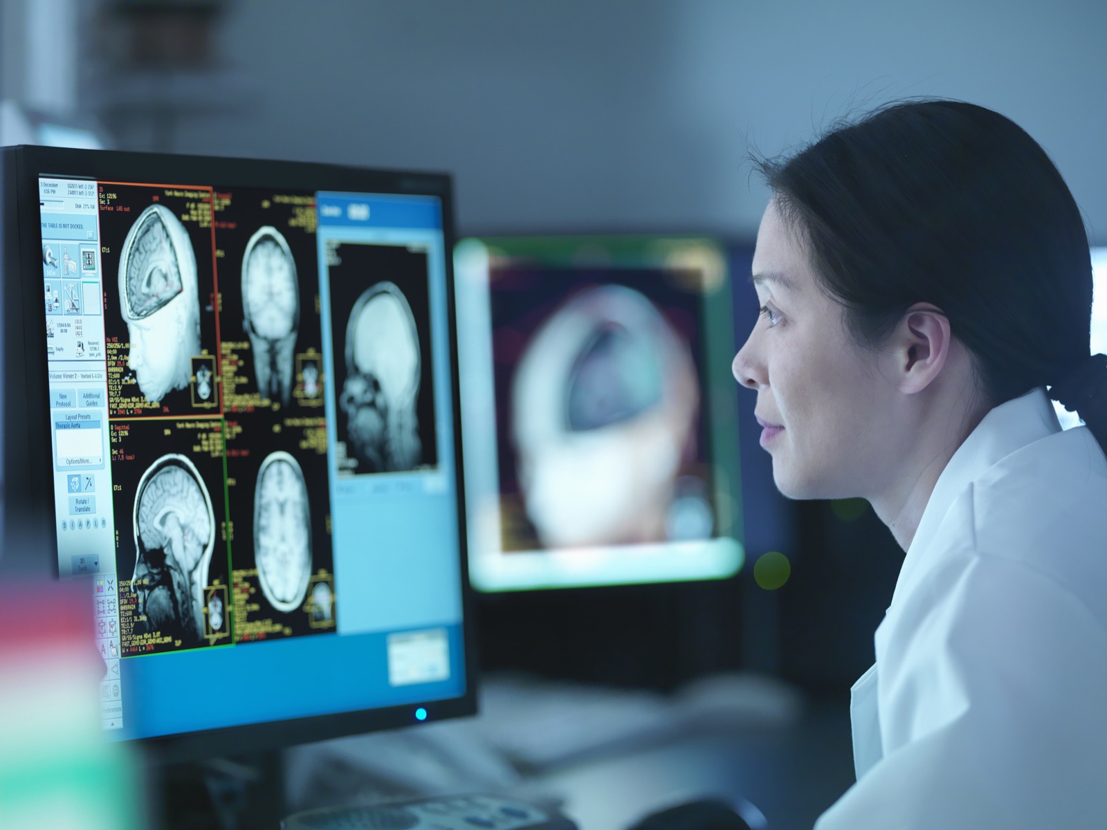 Scientist reviewing 3D rendered graphic scans from a Magnetic Resonance Imaging scanner